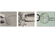 100 Loci of 18 Deafness-Related Genes Detection