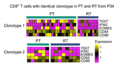 Differential-gene-expression-of-the-same-clonotype-in-different-subgroups.jpg